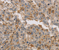 KIF17 Polyclonal Antibody – Figure 1 of 2