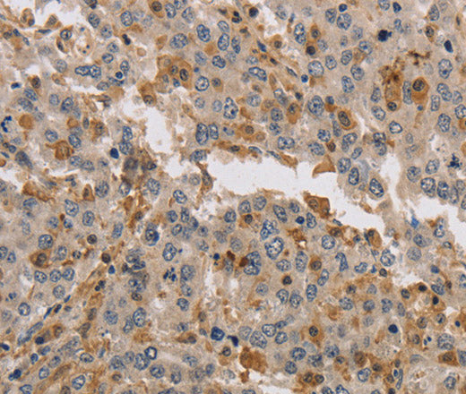 KIF17 Polyclonal Antibody – Figure 1 of 2