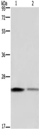 EMC8 Polyclonal Antibody – Figure 1 of 4