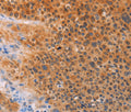 ADHFE1 Polyclonal Antibody – Figure 1 of 3