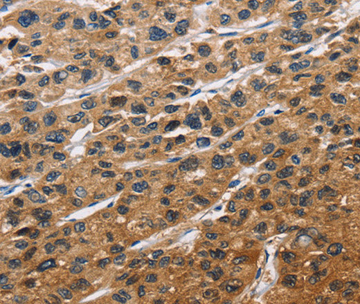 EIF4EBP2 Polyclonal Antibody – Figure 1 of 3