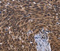 FASTKD5 Polyclonal Antibody – Figure 1 of 3
