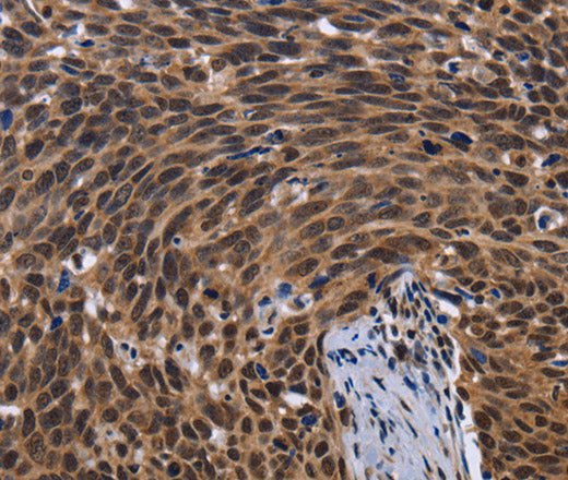 FASTKD5 Polyclonal Antibody – Figure 1 of 3