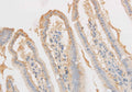 VDAC1 Polyclonal Antibody – Figure 1 of 3