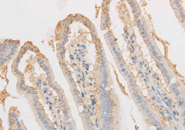 VDAC1 Polyclonal Antibody – Figure 1 of 3