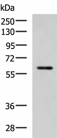ECM1 Polyclonal Antibody – Figure 1 of 3