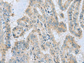 MGME1 Polyclonal Antibody – Figure 1 of 3