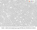 SKOV3 Cells Stably Expressing TOPORS-AS1 (TOPORS-AS1 SKOV3) | Applied Biological Materials (abm)