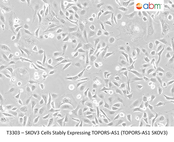 SKOV3 Cells Stably Expressing TOPORS-AS1 (TOPORS-AS1 SKOV3) | Applied Biological Materials (abm)