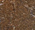 KDM4B Polyclonal Antibody – Figure 1 of 3