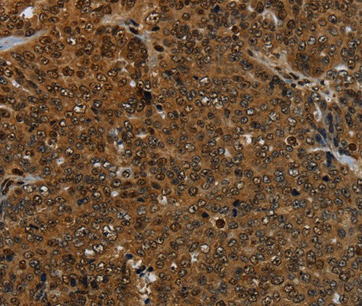 KDM4B Polyclonal Antibody – Figure 1 of 3