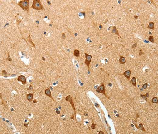 BIRC6 Polyclonal Antibody – Figure 1 of 3