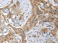 THOC3 Polyclonal Antibody – Figure 1 of 2