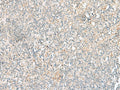 GSKIP Polyclonal Antibody – Figure 1 of 3