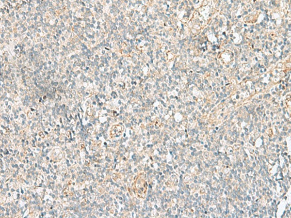 GSKIP Polyclonal Antibody – Figure 1 of 3
