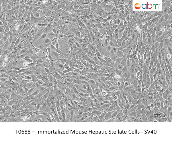 Immortalized Mouse Hepatic Stellate Cells - SV40 – Figure 1 of 1