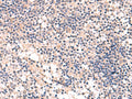 MKS1 Polyclonal Antibody – Figure 1 of 2