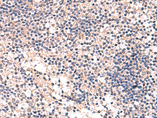MKS1 Polyclonal Antibody – Figure 1 of 2