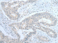 ITGA8 Polyclonal Antibody – Figure 1 of 2