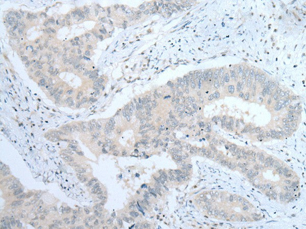 ITGA8 Polyclonal Antibody – Figure 1 of 2