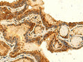 HS1BP3 Polyclonal Antibody – Figure 1 of 2