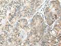 SLAMF7 Polyclonal Antibody – Figure 1 of 2