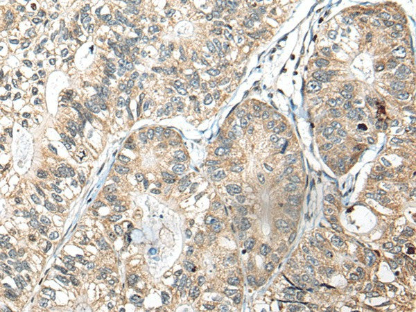 SLAMF7 Polyclonal Antibody – Figure 1 of 2