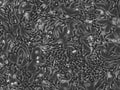 VERO cell