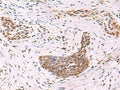 CREBBP Polyclonal Antibody – Figure 1 of 3