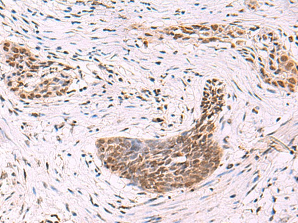 CREBBP Polyclonal Antibody – Figure 1 of 3
