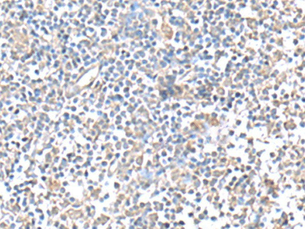 IFI27 Polyclonal Antibody – Figure 1 of 2