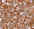HSPB6 Polyclonal Antibody – Figure 1 of 3