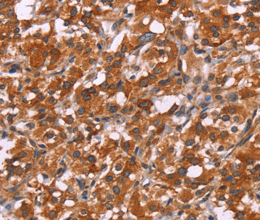 HSPB6 Polyclonal Antibody – Figure 1 of 3