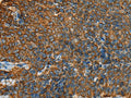 YBX1 Polyclonal Antibody – Figure 1 of 3