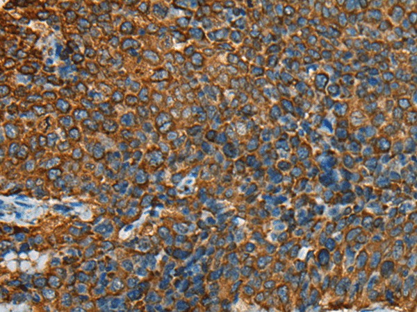 YBX1 Polyclonal Antibody – Figure 1 of 3