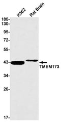 Recombinant Transmembrane Protein 173 Monoclonal Antibody – Figure 1 of 3