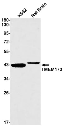 Recombinant Transmembrane Protein 173 Monoclonal Antibody – Figure 1 of 3