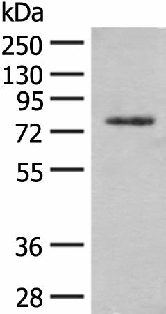 TRMT1 Polyclonal Antibody – Figure 1 of 4