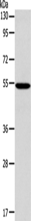ERG Polyclonal Antibody – Figure 1 of 4