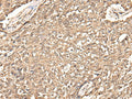 USP21 Polyclonal Antibody – Figure 1 of 2