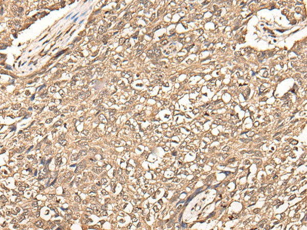 USP21 Polyclonal Antibody – Figure 1 of 2