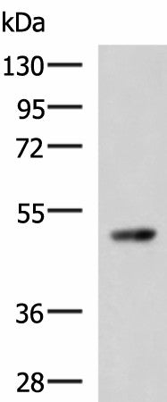 TP53 Polyclonal Antibody – Figure 1 of 2