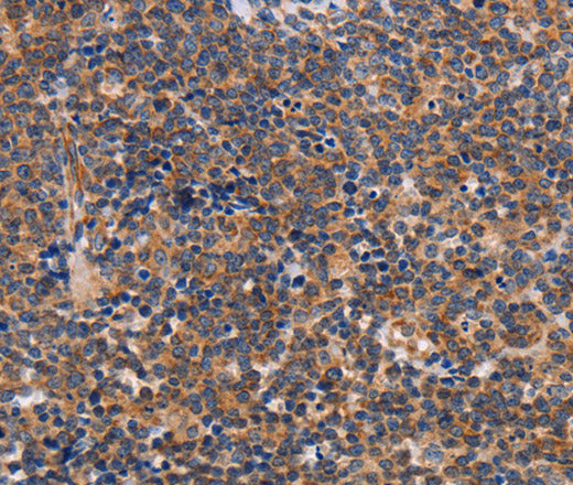 ALG9 Polyclonal Antibody – Figure 1 of 3