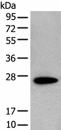 CD63 Polyclonal Antibody – Figure 1 of 2
