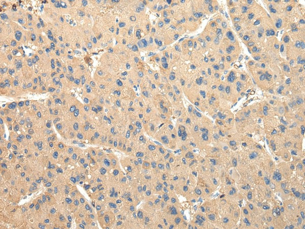 DUSP11 Polyclonal Antibody – Figure 1 of 2