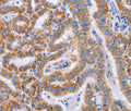 BST1 Polyclonal Antibody – Figure 1 of 3