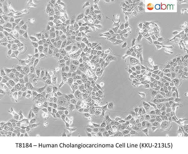 Human Cholangiocarcinoma Cell Line (KKU-213L5) | Applied Biological Materials (abm)