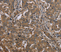 MCC Polyclonal Antibody – Figure 1 of 3