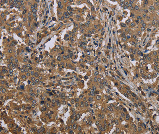 MCC Polyclonal Antibody – Figure 1 of 3