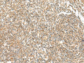 ORC4 Polyclonal Antibody – Figure 1 of 3